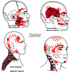 Bruxismo-Y-Dolor-Cervical-Trapecio